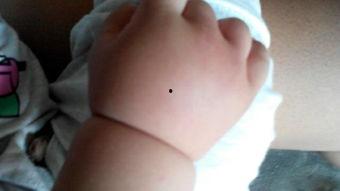 手肿了图片,探寻成因与缓解之道